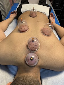 Holistic Hijama Benefits place picture